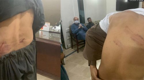 Journalists tortured by police in Pakistan